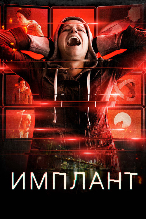 Постер: Имплант